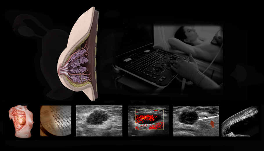 Comprehensive live hands-on ultrasound protocols and techniques to master ultrasound scanning for women's and men's breast sonography.