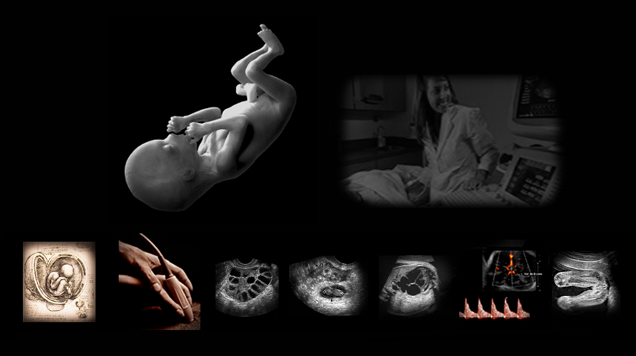 Hands-On Obstetric ultrasound training.