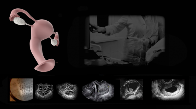 Comprehensive live hands-on ultrasound protocols and techniques to master transvaginal pelvic ultrasound scanning.